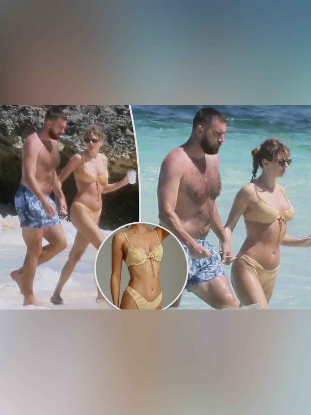 Montce Canary Stripe Bikini Set - As Seen on Taylor Swift